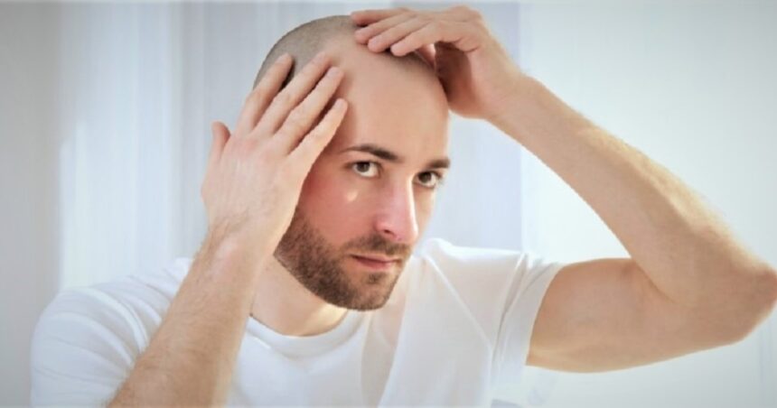 ¿Qué enfermedades pueden causar la caída del cabello? ¿Qué enfermedades pueden causar la caída del cabello?