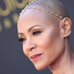 ¿Cómo puedo saber si tengo tiña o alopecia areata?