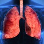 Cuáles son los efectos positivos para los pulmones por consumir Omega-3