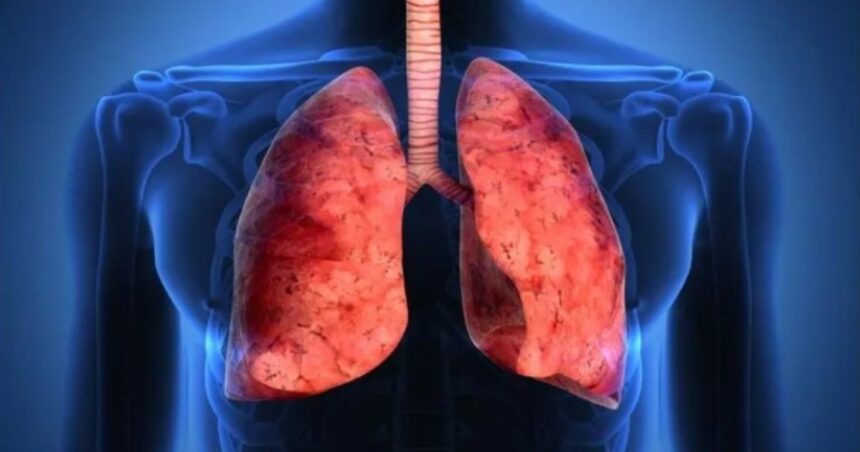 Cuáles son los efectos positivos para los pulmones por consumir Omega-3
