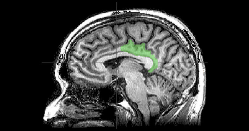 Descubren en el cerebro por qué nos afectan tanto los recuerdos más traumáticos