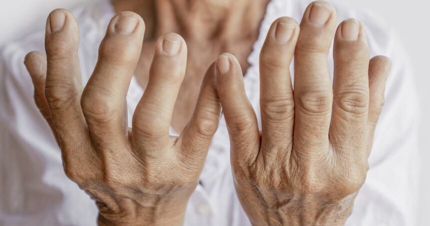 ¿Hay una vacuna para combatir la artritis reumatoide? ¿Hay una vacuna para combatir la artritis reumatoide?