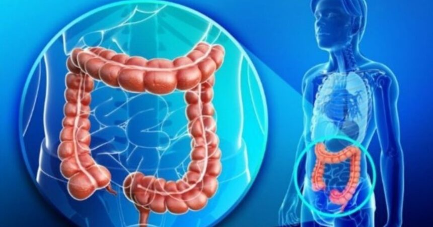 Cuándo debería hacer la prueba para la detección de cáncer de colón Cuándo debería hacer la prueba para la detección de cáncer de colón