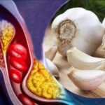 Cómo consumir el ajo para bajar el colesterol y el azúcar en sangre