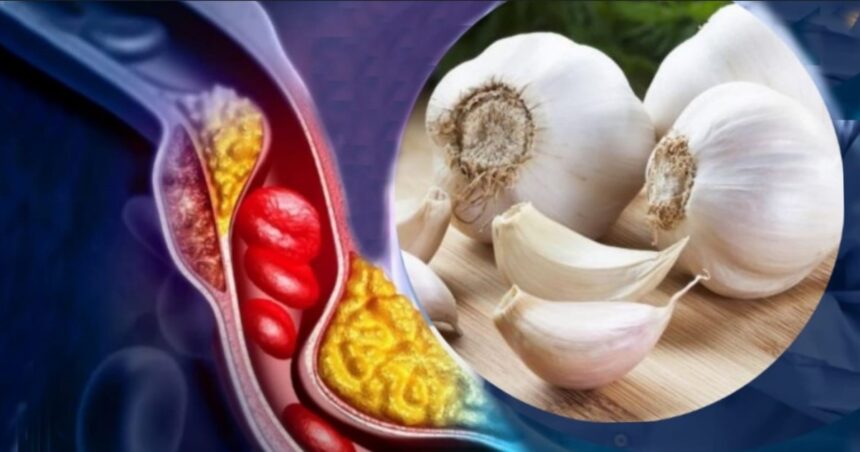 Cómo consumir el ajo para bajar el colesterol y el azúcar en sangre Cómo consumir el ajo para bajar el colesterol y el azúcar en sangre