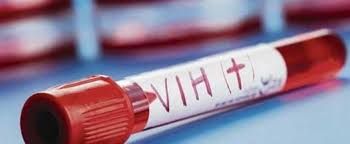 La Rioja tiene uno de los índices más altos de HIV en el país La Rioja tiene uno de los índices más altos de HIV en el país