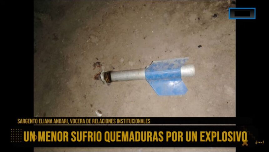Aimogasta: niño sufrió quemaduras por un explosivo Aimogasta: niño sufrió quemaduras por un explosivo