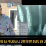 Denuncia que la policía le cortó un dedo en la comisaria
